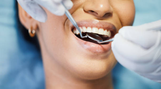 Best Chipped Tooth Repair Near Me  in New City, NY